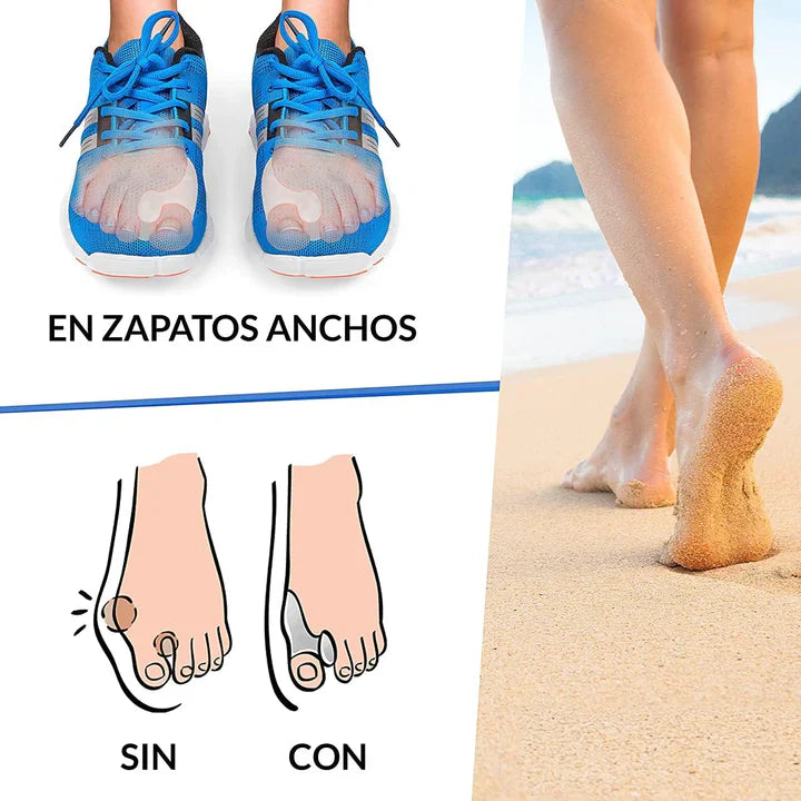 Corrector de Juanetes - Hallux™